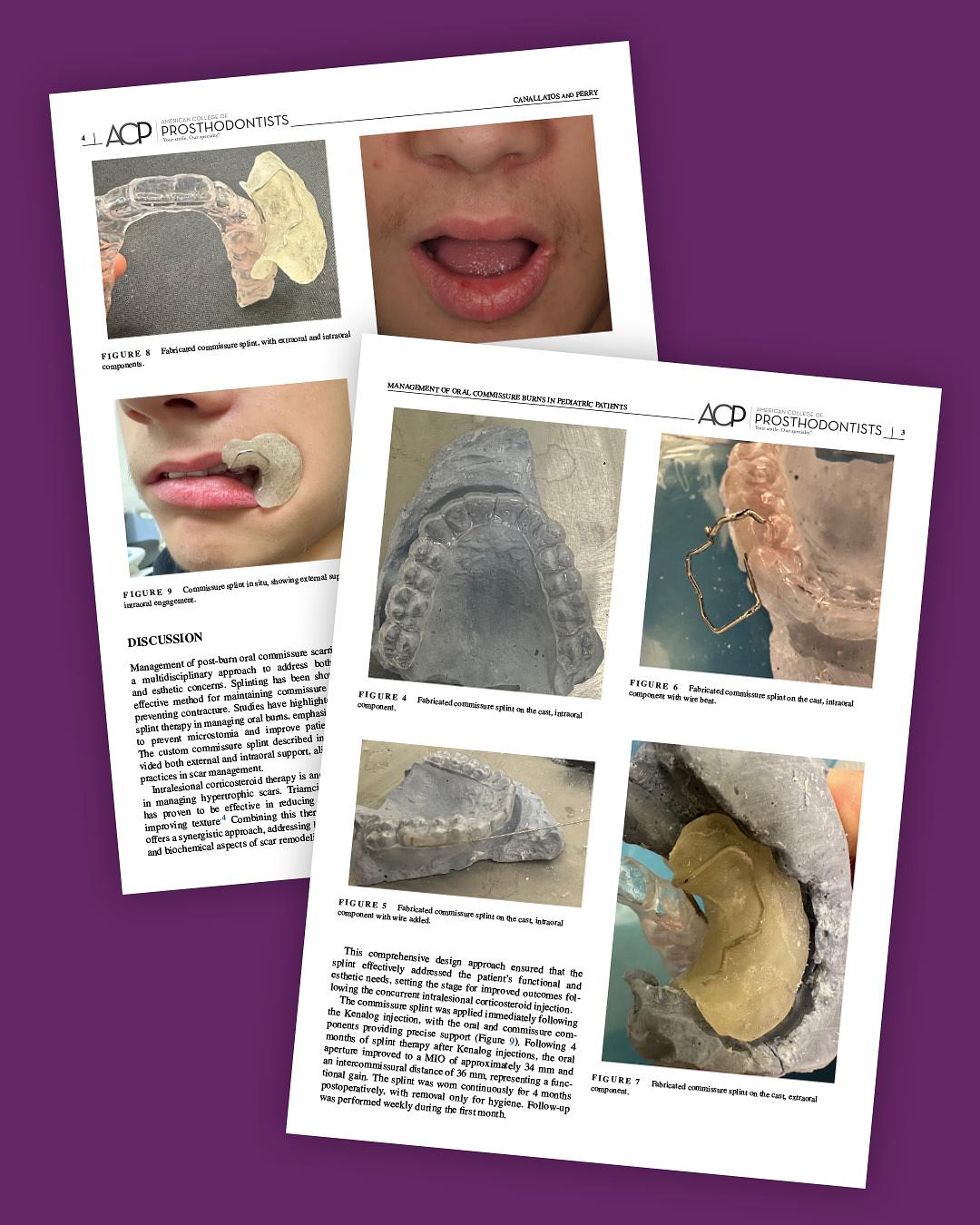 New research: Healing pediatric burn injuries through multidisciplinary approach